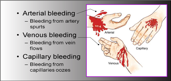 Stop Bleeding Kits, First Aid, First Add Training, Training CPR, Training CCR, Trauma Kit Training, business first aid kits, first aid kit business, Business Trauma Kit And Training